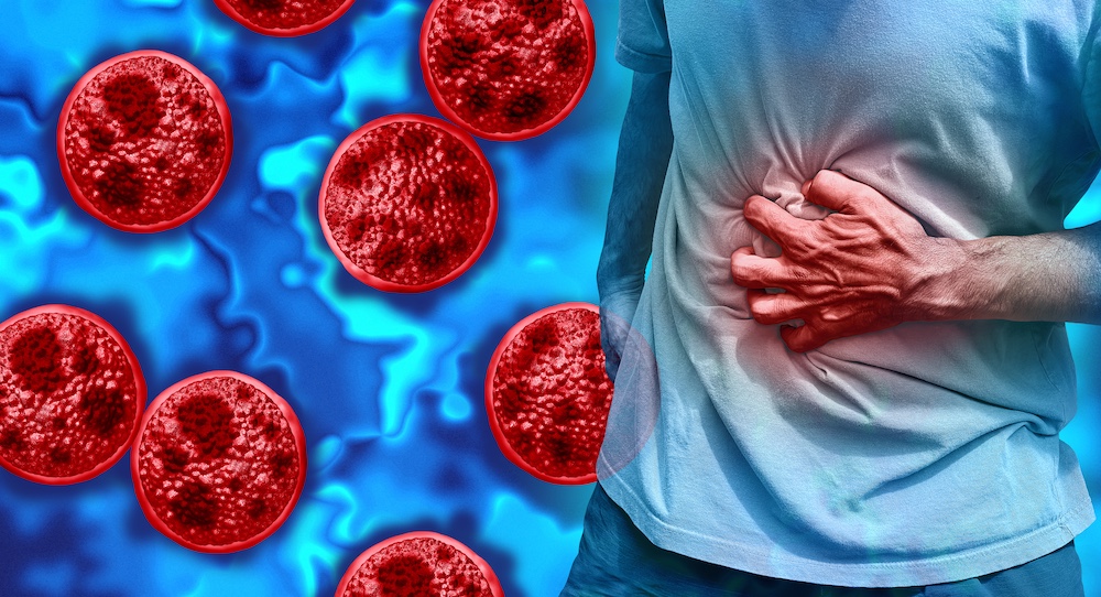 Cyclospora Cases Rise Nationwide: Houston Methodist Shares a Step-by-Step Guide for Stomach Illness Recovery