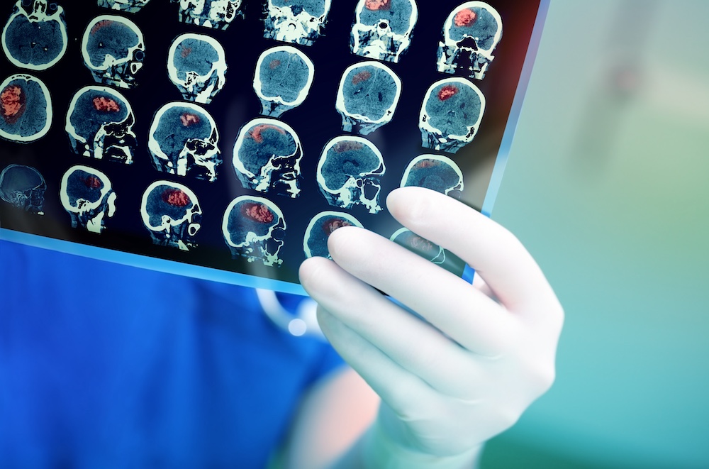 Ascension Seton’s First Mobile Stroke Unit Could Bring Critical Brain Care Directly to Central Texas Patients